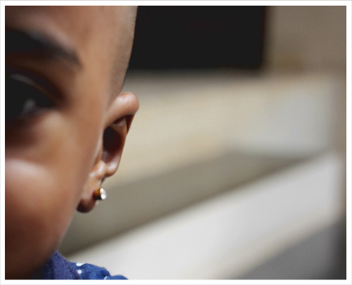 Tonsured Head of a Baby